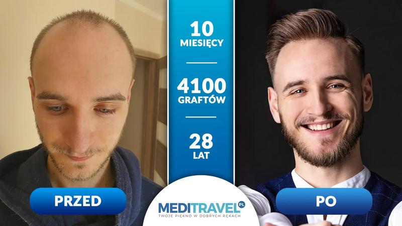 Kultura i turystyka medyczna