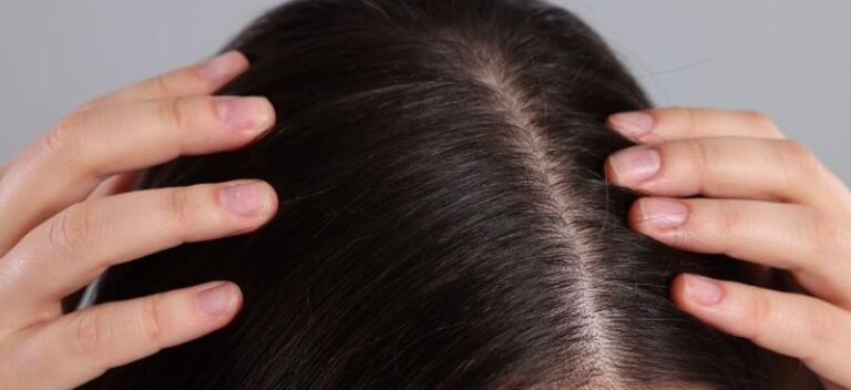 Co Może Oznaczać Sen O Wszach? Oto Kilka Interpretacji Z Sennika